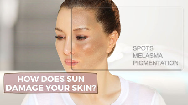 HOW DOES SUN DAMAGE YOUR SKIN?